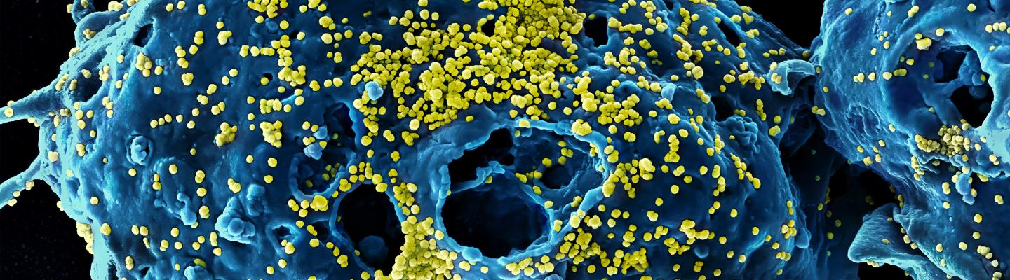 MERS virus cells